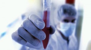 Infectiile-cu-rotavirus-ucid-anual-Foto-Vimeo