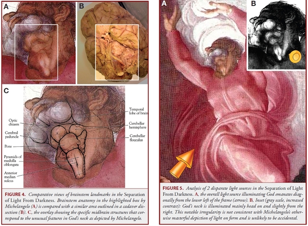 creier4 michelangelo capela sixtina